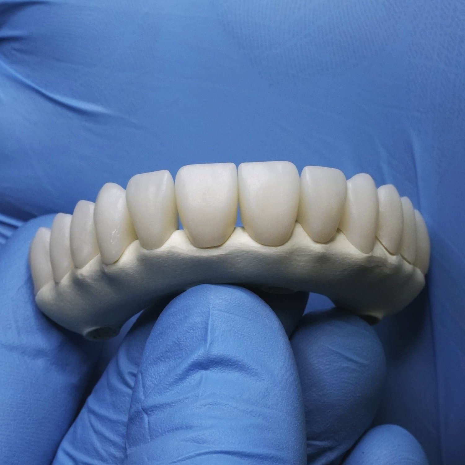 A finished zirconia arch held in a gloved hand